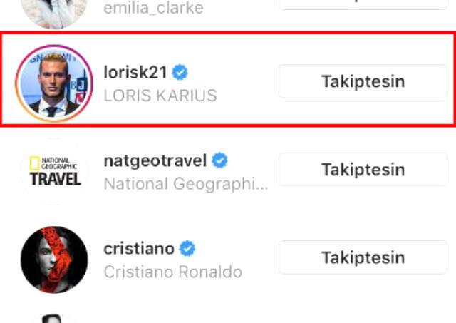 Metin Hara'yla Ayrıldığı İddia Edilen Adriana Lima, Loris Karius ile Takipleşmeye Başladı