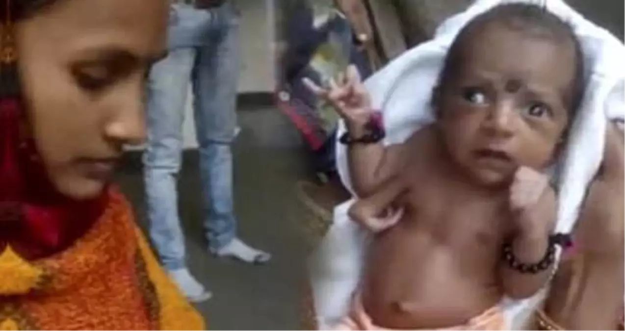 3 Kollu Doğan Bebeği 'Peygamber' İlan Edip İbadet Etmeye Başladılar