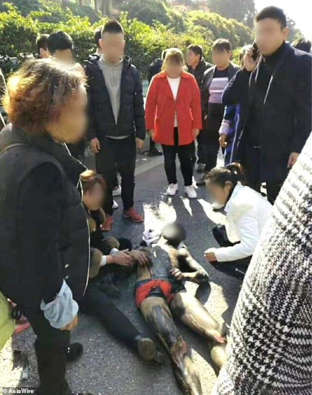 Gelenek Gereği Düğün Günü Arkadaşlarından Dayak Yiyen Damat, Aracın Altında Kaldı
