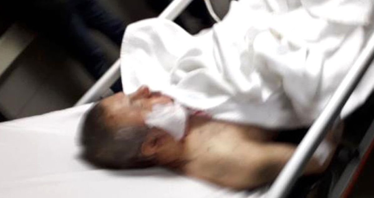İYİ Parti'den Aday Adayı Olan Hüsamettin Kul, Başından Bıçaklandı