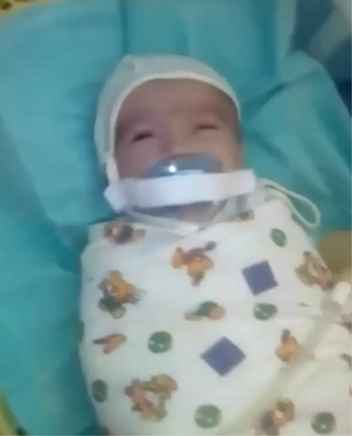 Rusya'da Kuvözdeki Bebeğe Emzik İşkencesi
