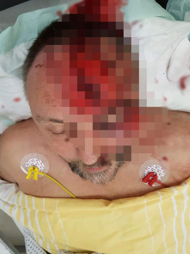 Almanya'da Milletvekili Frank Magnit, 3 Zanlının Saldırısına Uğradıktan Sonra Ölüme Terk Edildi