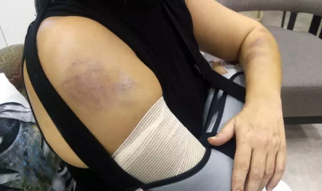 Estetisyen Doktora Beyzbol Sopasıyla Saldırdılar Estetisyen Doktora Beyzbol Sopasıyla Saldırdılar