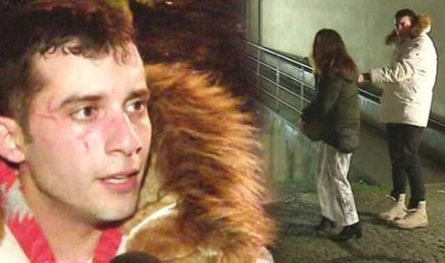 Sevgilisinden Dayak Yediği İddia Edilen Ünlü Oyuncu Açıklama Yaptı