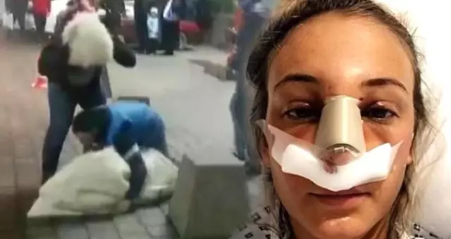 Sakar Damat Adayı, Evleneceği Kadını Kaçırmak İsterken Hastanelik Etti, Görüntüler Sosyal Medyayı Salladı Sakar Damat Adayı, Evleneceği Kadını Kaçırmak İsterken Hastanelik Etti, Görüntüler Sosyal Medyayı Salladı