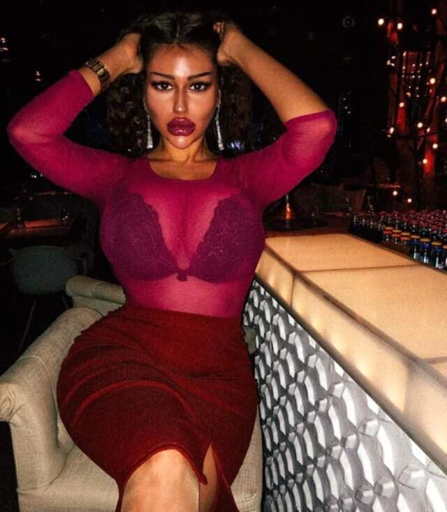 Rusya'nın Kim Kardashian'ından Şaşırtan İtiraf: Estetik Operasyon Geçirmedim