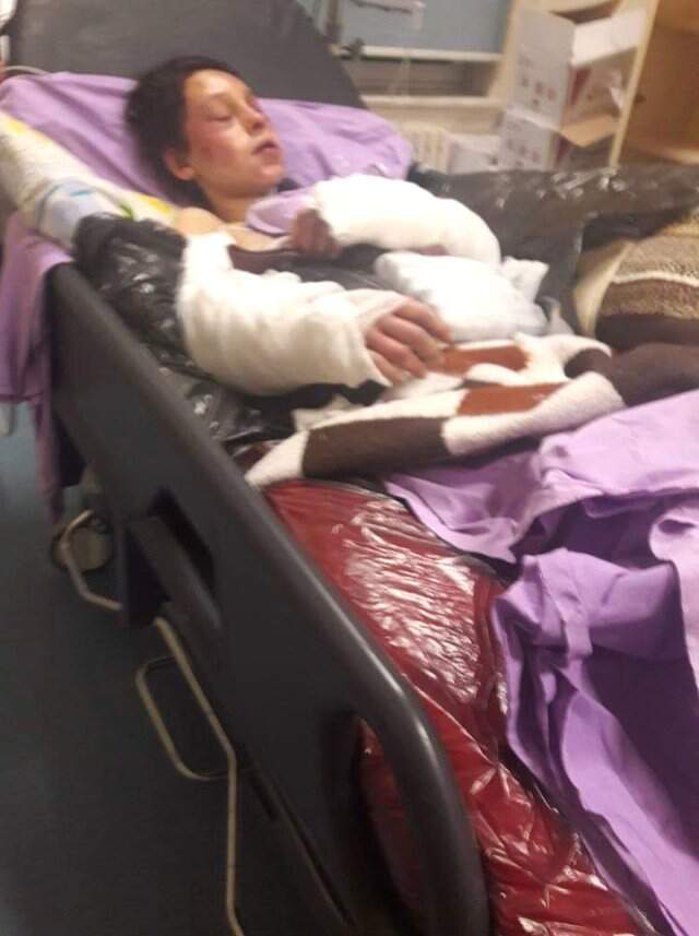 Vicdansız Adam, 5 Aylık Hamile Karısının Vücudunda Kırılmadık Yer Bırakmadı