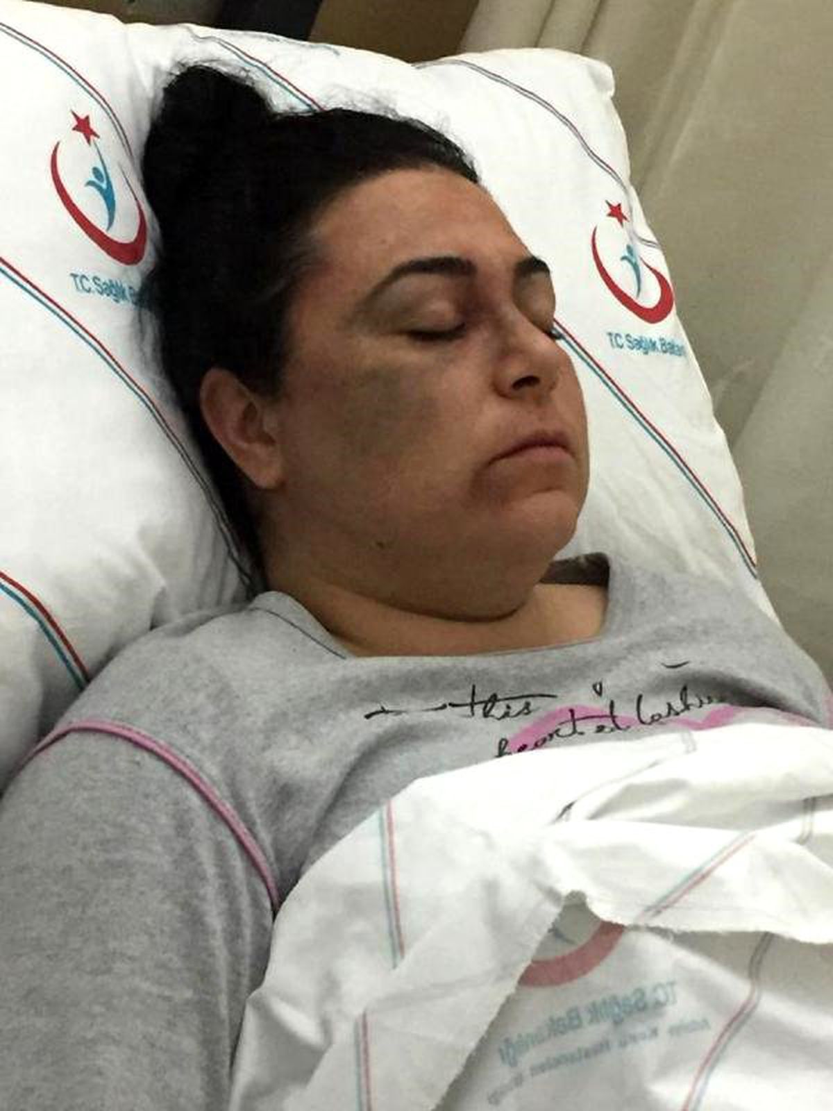 3 Kadını Hastanelik Eden Saldırgan, 'Kendimi Savundum' Deyip Serbest Kaldı