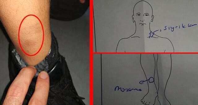 İstanbul'da Kadın Öğretmen Dehşeti! 11 Yaşındaki Öğrencinin Boğazını Sıkıp Tekmeledi