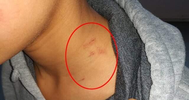 İstanbul'da Kadın Öğretmen Dehşeti! 13 Yaşındaki Öğrencinin Boğazını Sıkıp Tekmeledi