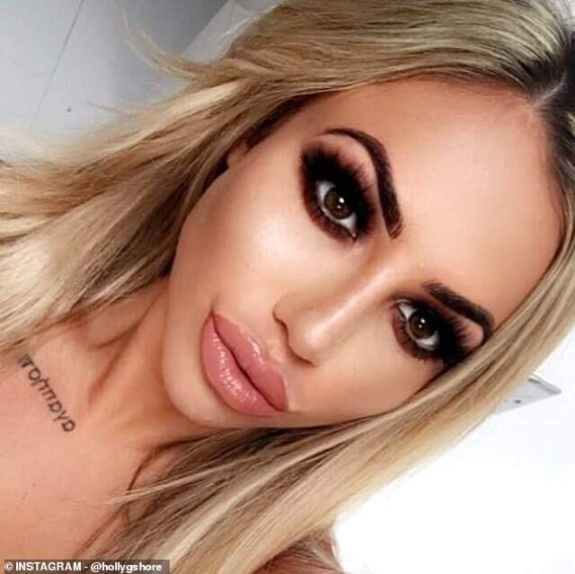 İngiliz Televizyon Yıldızı Holly Hagan'ın Lazerden Yüzü Yandı
