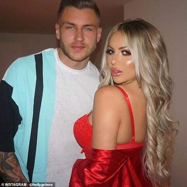 İngiliz Televizyon Yıldızı Holly Hagan'ın Lazerden Yüzü Yandı