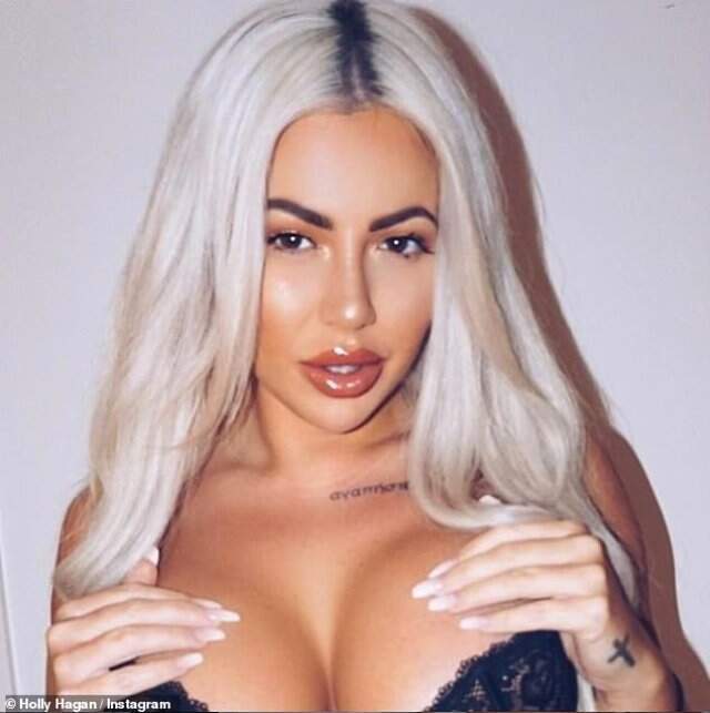 İngiliz Televizyon Yıldızı Holly Hagan'ın Lazerden Yüzü Yandı