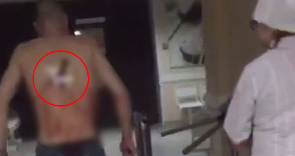 Yaralı Adam, Sırtına Saplanan Bıçakla Sigara İçmeye Çıktı