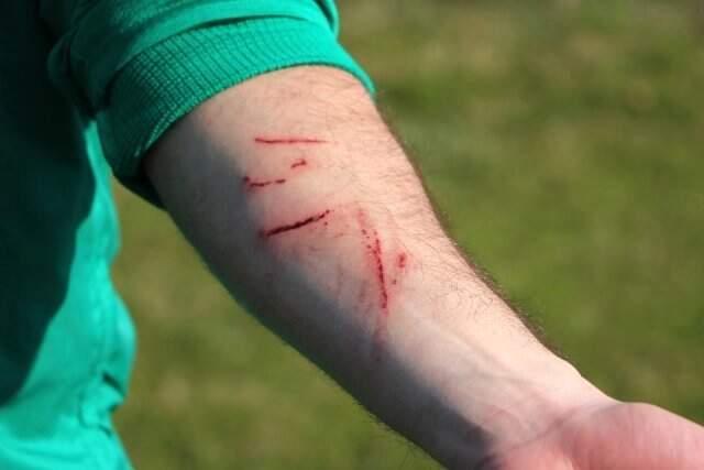 Sakaryasporlu Futbolcular, Amedspor Maçında Yaşadıklarını Anlattı