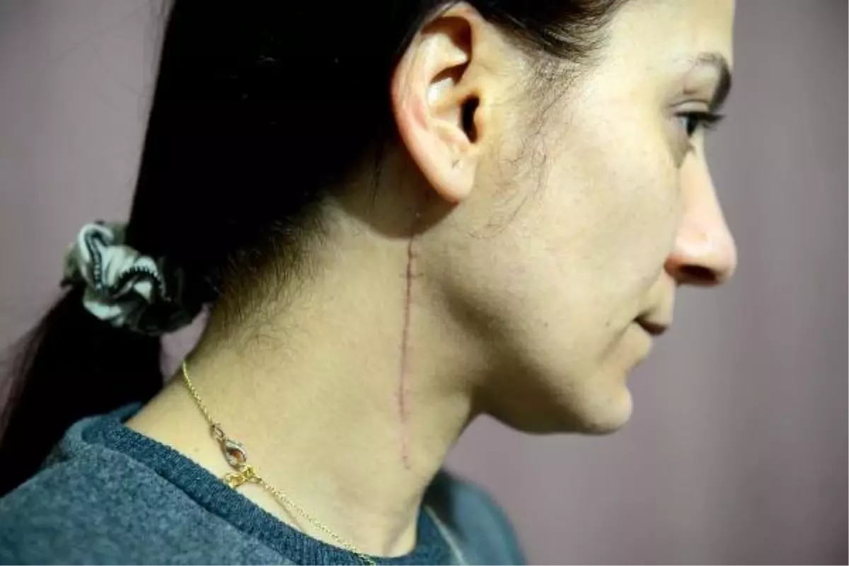 Vücuduna 80 Dikiş Atılan Genç Kadından, Saldırgana 8 Yıl Hapis Cezası İstenmesine Tepki