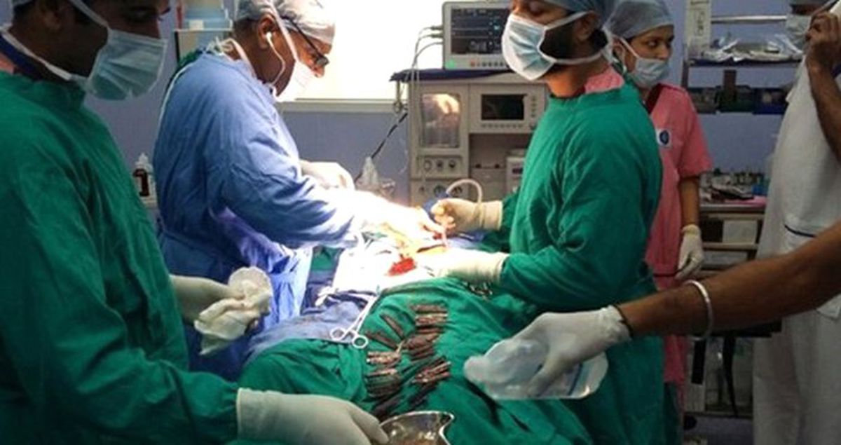 Hindistan'da Psikolojik Sorunları Olan Hastanın Karnından Onlarca Kapı Anahtarı Çıktı