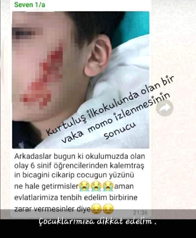 Kız Öğrenci Sınıfta Şakalaştığı Arkadaşını Kalemtıraş Bıçağı ile Yaraladı