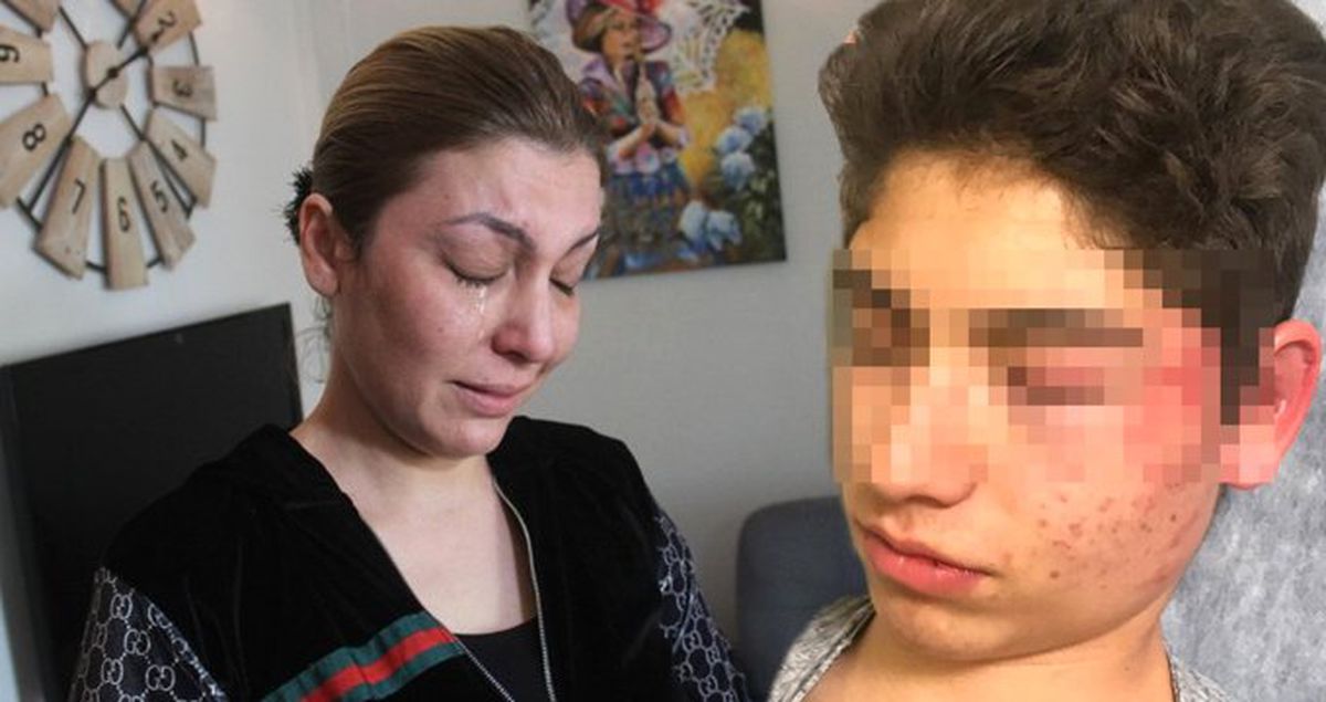 Kız Arkadaşının Eski Sevgilisini Boks Makinesi Yerine Koyup Dövdü, Arkadaşı Videoya Çekti