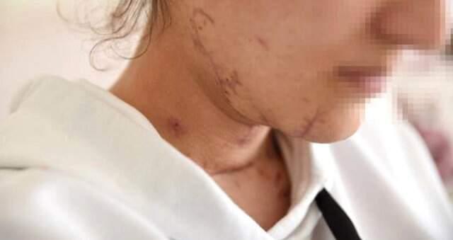 Önce Boğazı Kesilen Daha Sonra da Defalarca Bıçaklanan 25 Yaşındaki Kız, Polisler Sayesinde Kurtuldu