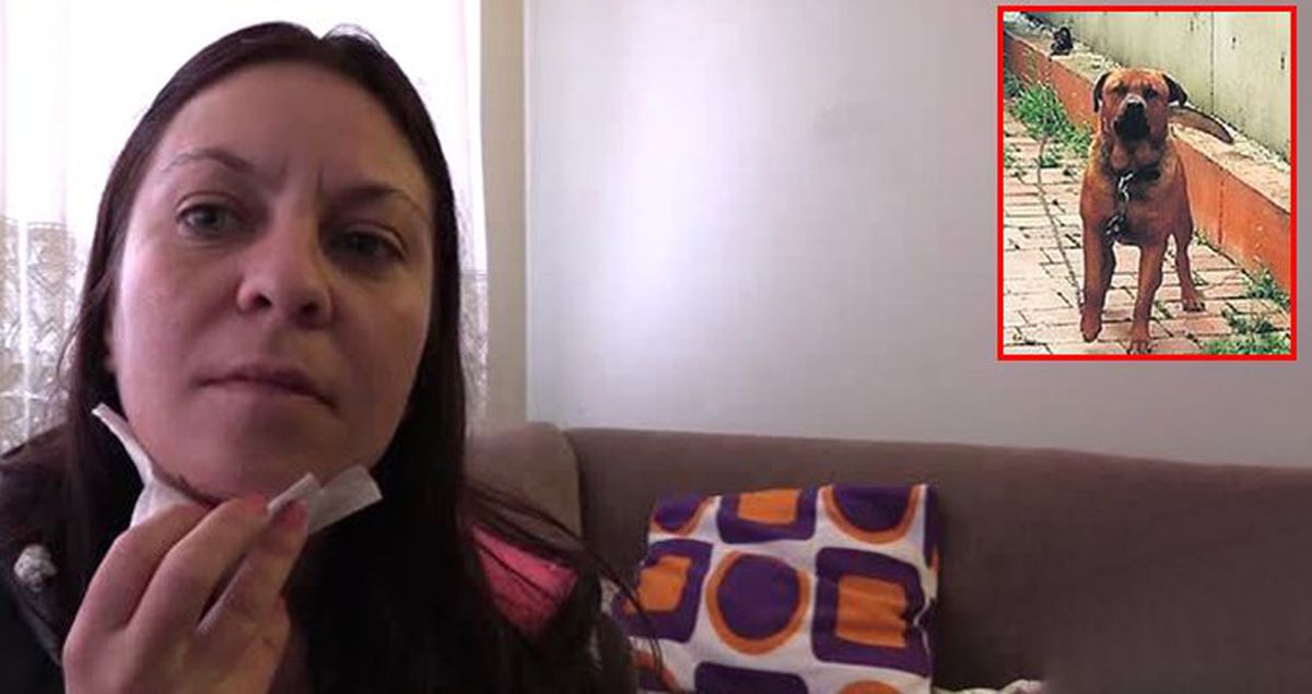 Zincirini Koparan Köpek, İş Görüşmesine Giden Kadına Saldırdı