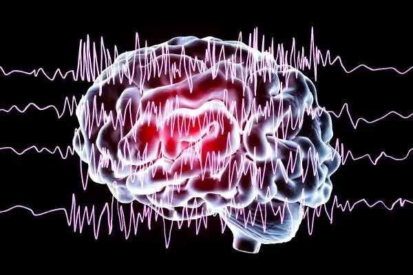 Akraba Evliliği Epilepsi Riskini 40 Kat Artırıyor