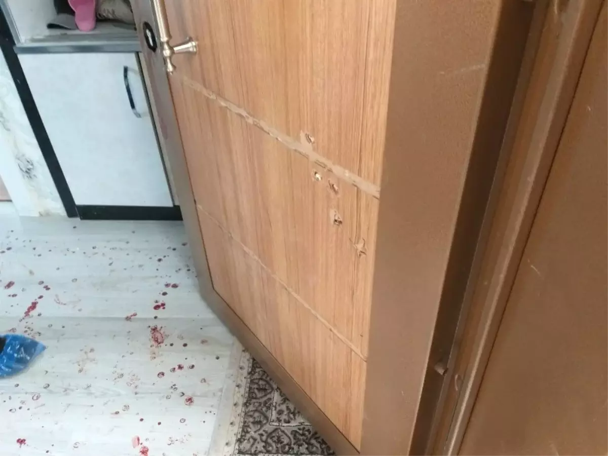 Başkent'te Çocukların Oyunu Kanlı Bitti