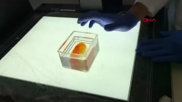 Almanya, 3 Boyutlu Yazıcılarla Yapay Organ Geliştiren Türk Doktoru Konuşuyor