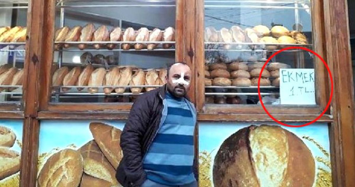 'Ekmeği Ucuza Satıyorsun' Deyip Fırıncının Burnunu Kırdılar! O Anlar Kamerada