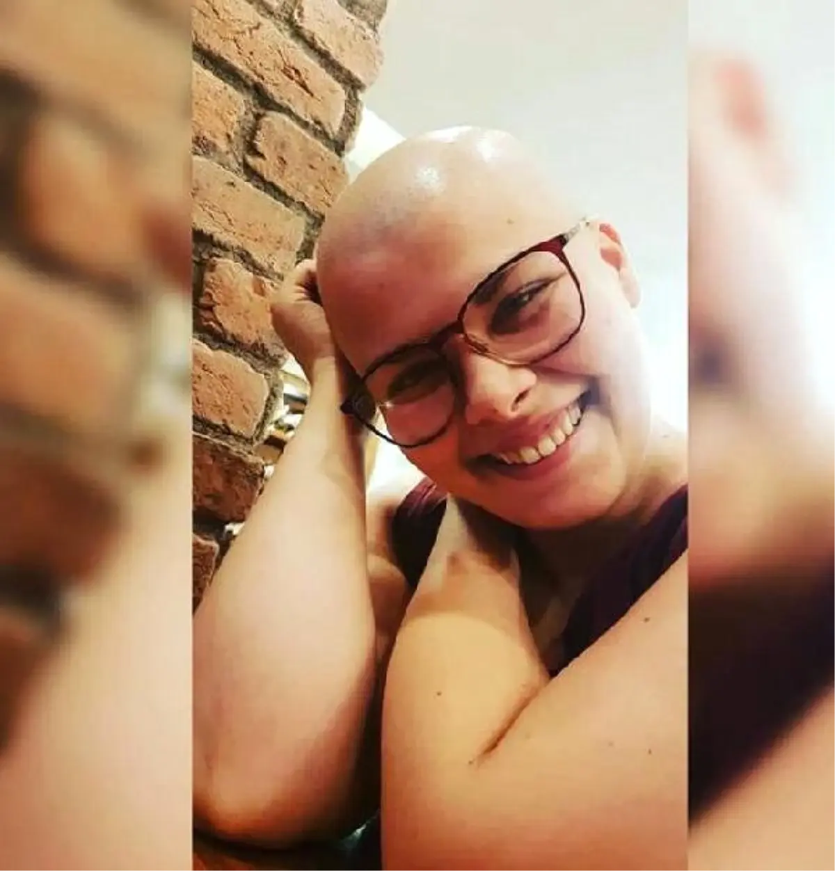 Kanser Hastasi Tugce Hayatini Kaybetti Haber