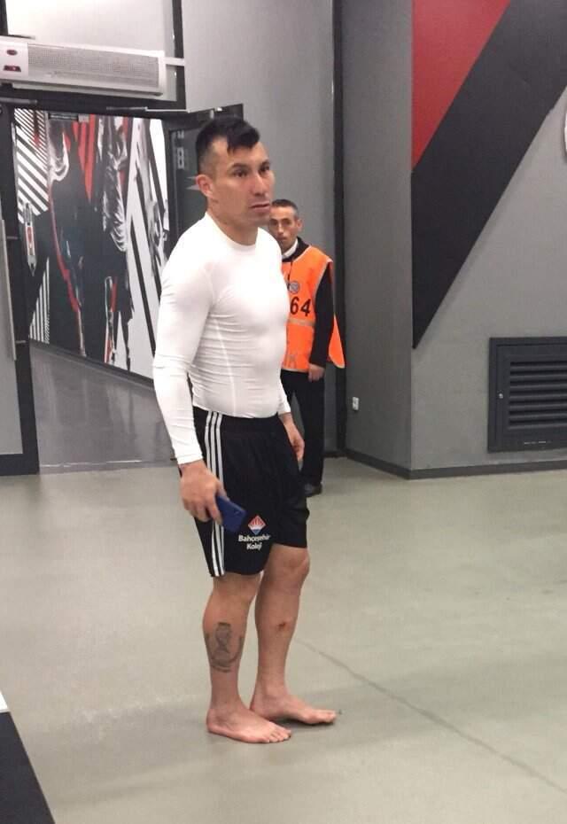 Başakşehir Maçını Tamamlayamayan Gary Medel'in Bacağı Delindi!