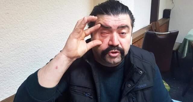 Asker Uğurlamasında Terör Estiren Saldırganlar Tartıştıkları Adamın Gözünü Çıkardı