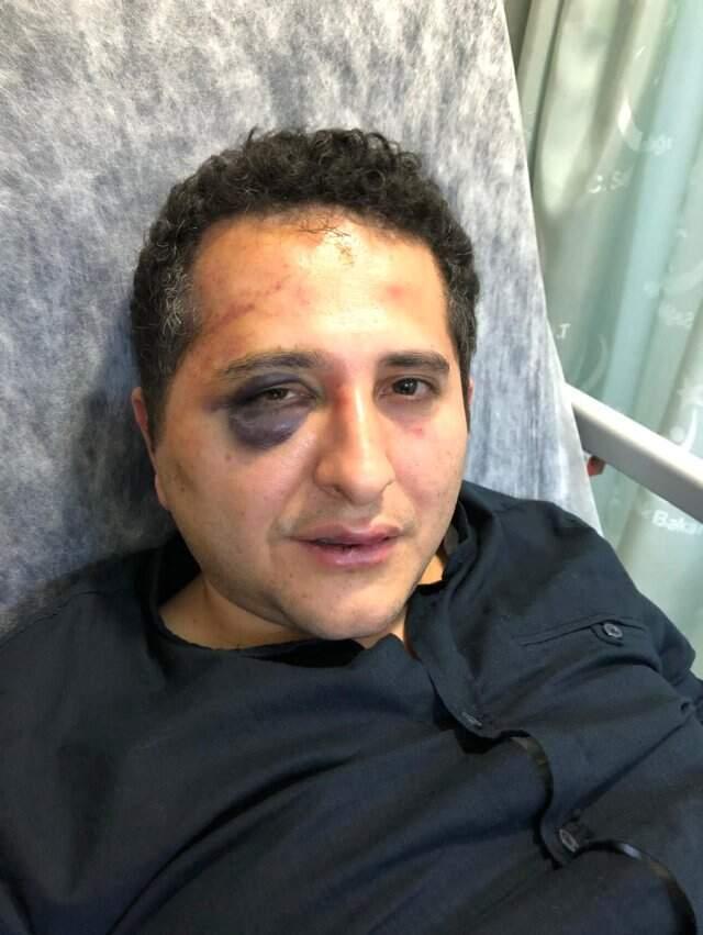 'Erdoğan Korumalarından Avukata Dayak' İddiasına Feyzioğlu'ndan Tepki: Fotoğrafa İyi Bakın, 3-5 Kabadayı Bunu Yaptı