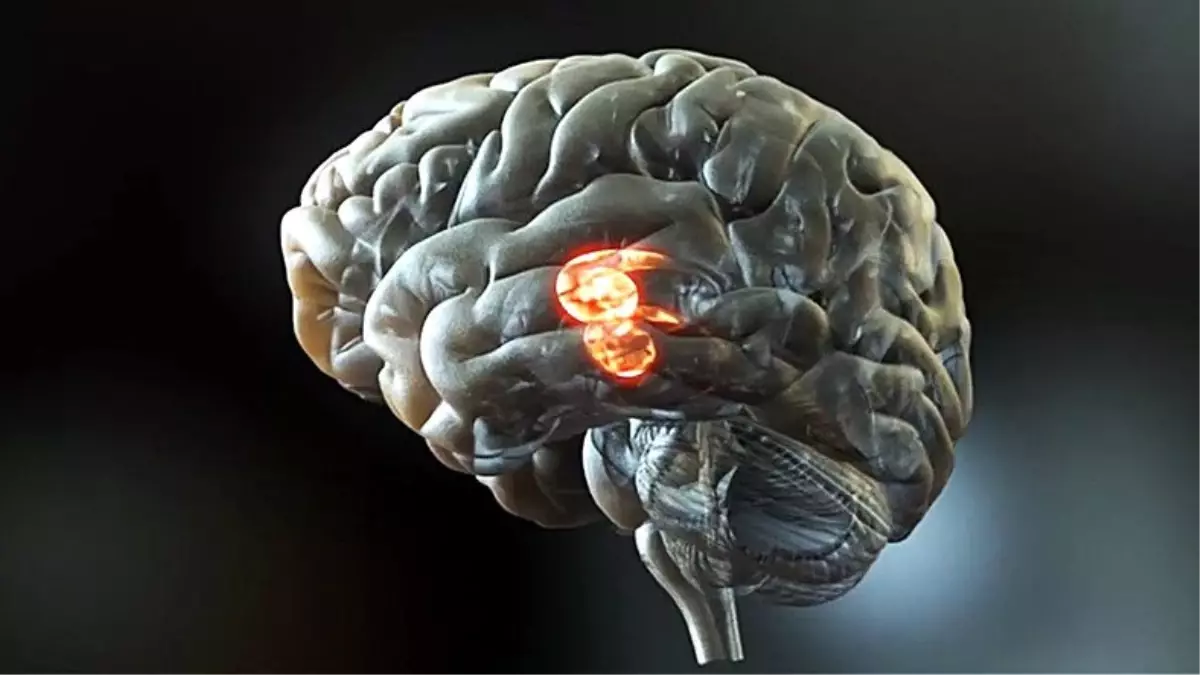 Bilim İnsanları, Beyin Sinyallerini Konuşma Sesine Çeviren Bir İmplant Geliştirdi