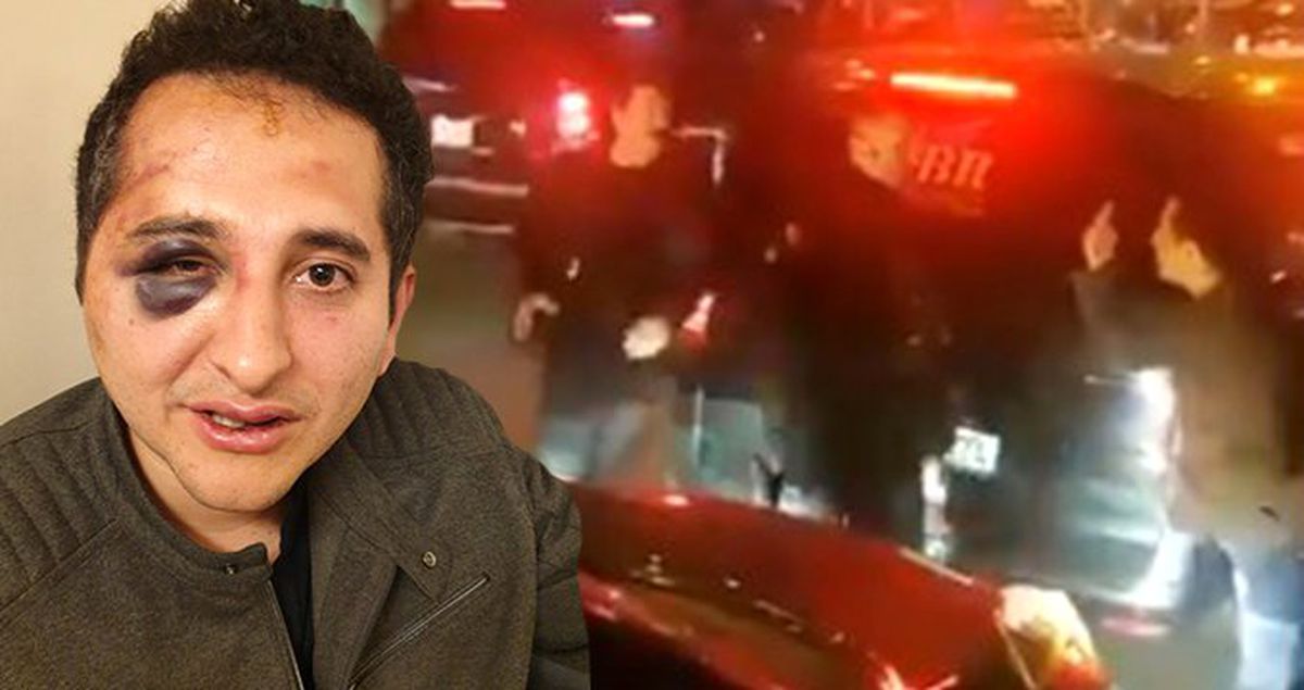 'Erdoğan'ın Korumaları Beni Dövdü' Diyen Avukatın Gözaltına Alınma Görüntüleri Ortaya Çıktı