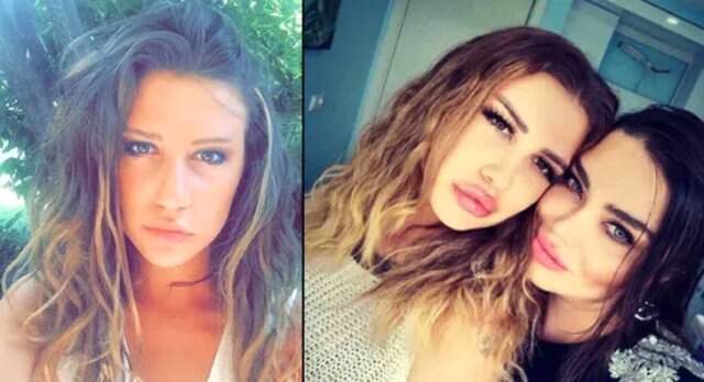Melis Buse Betkayan, Geçirdiği Estetik Operasyonları Sonrası Tanınmaz Hale Geldi