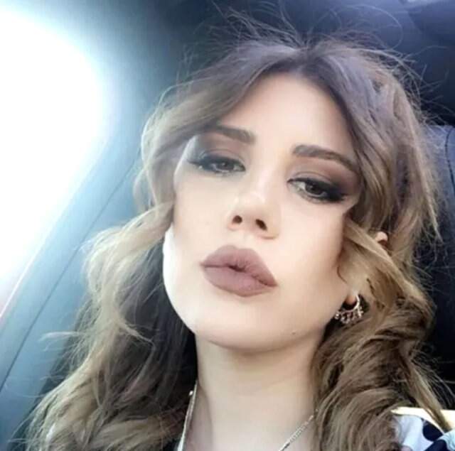 Melis Buse Betkayan, Geçirdiği Estetik Operasyonları Sonrası Tanınmaz Hale Geldi