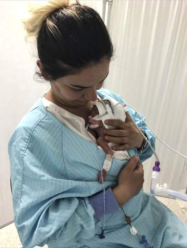 Korkunç Kazada Hamile Kadın Prematüre Doğum Yaptı! Alkollü Sürücü Kusurlu Bulunmadı