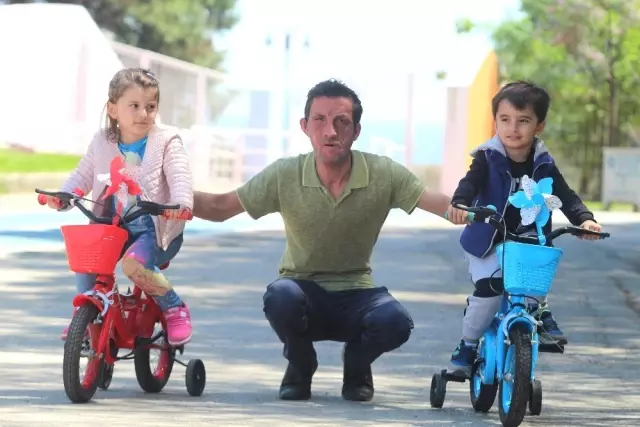 Yuz Nakilli Ugur Acar In Tek Hayali Evlenip Cocuk Sahibi Olmak Haberler