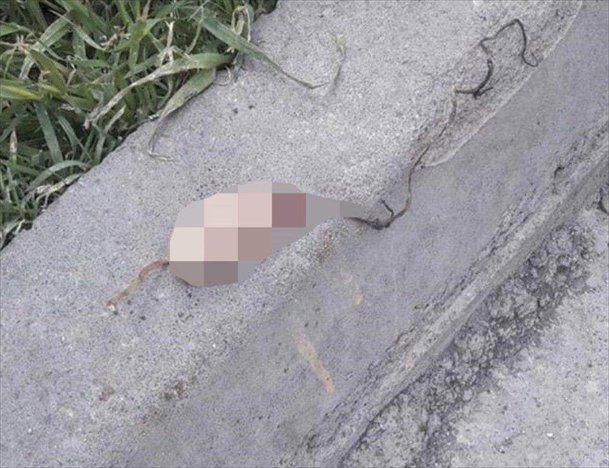 Şanlıurfa'da Kesik Parmaklar Bulundu