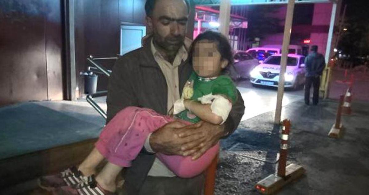 Esenyurt'ta Pitbull Dehşeti! Kameralar O Anda Kayıttaydı