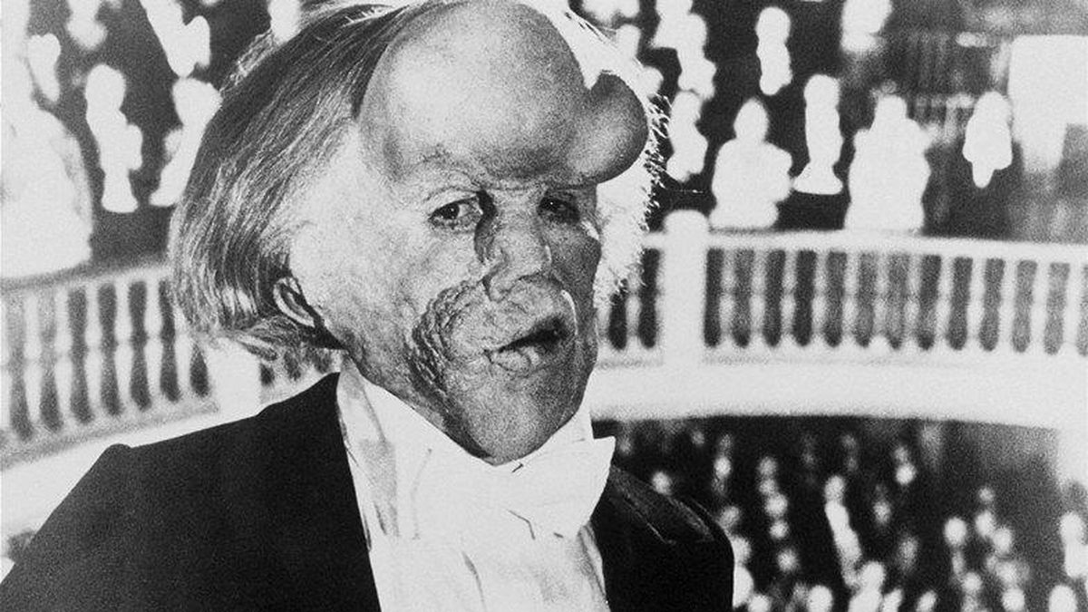 Filmlere Konu Olan 'Fil Adam'ın Mezarı, Öldükten 130 Yıl Sonra Bulundu