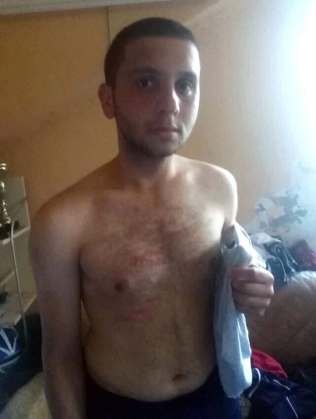Kırmızı Kartı Yedi, Rakibine Uçan Tekme Attı