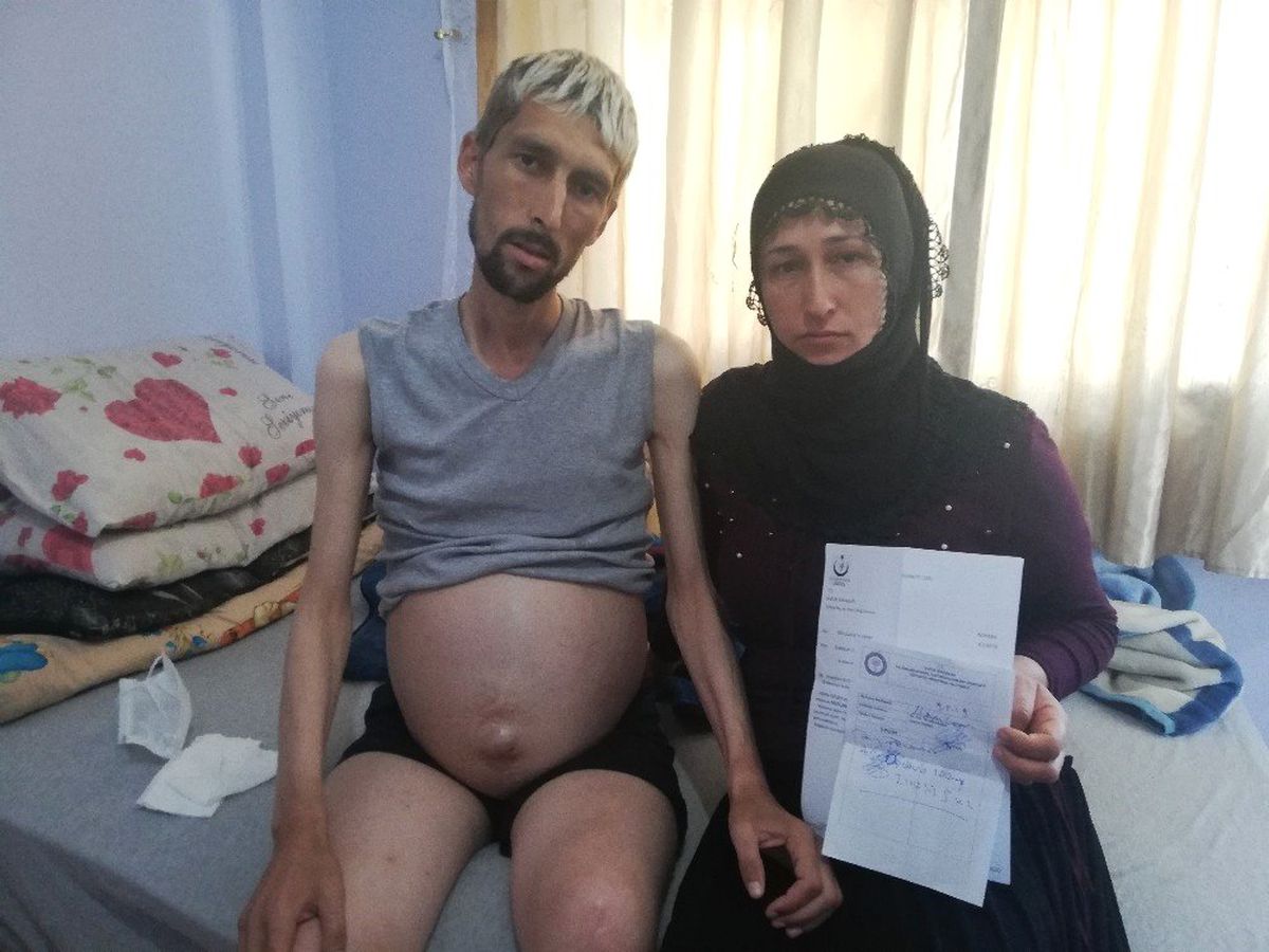 'Pecoma Kanseri' Genç Adamın Göz Yaşları