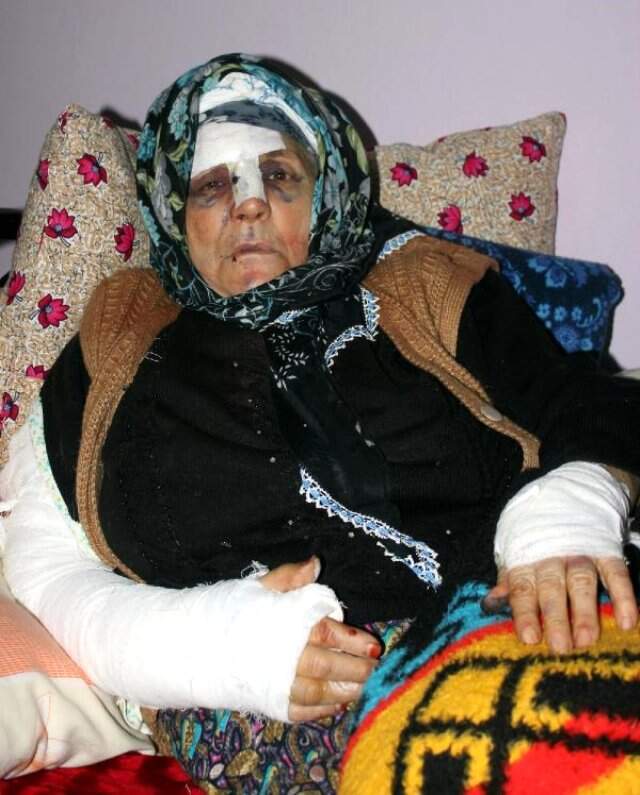Yaşlı Kadının Parmağını Kırıp Yüzüğünü Gasbeden Komşuya 13,5 Yıl Hapis