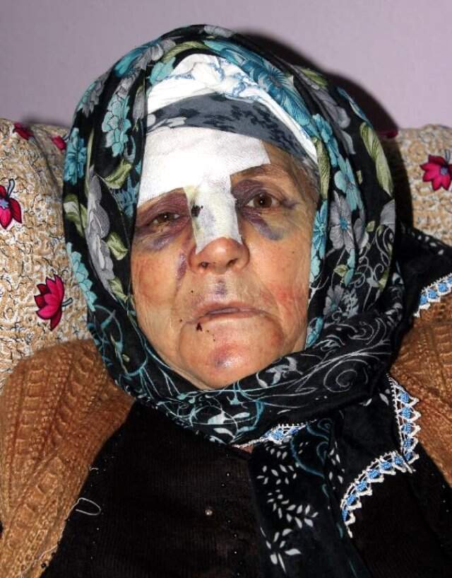 Yaşlı Kadının Parmağını Kırıp Yüzüğünü Gasbeden Komşuya 13,5 Yıl Hapis