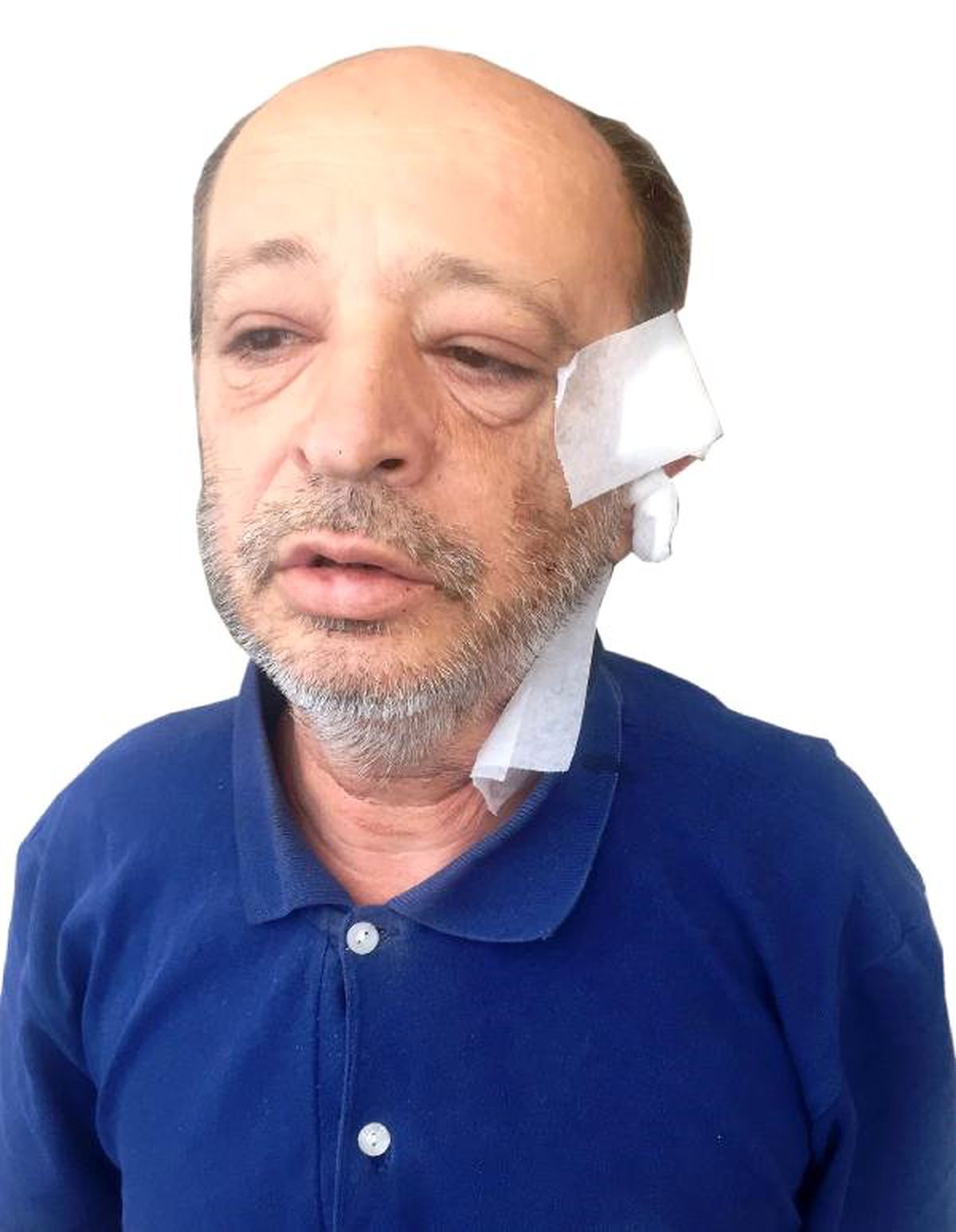'İspiyonculuğun sonu budur' diyerek arkadaşının kulağını kesti