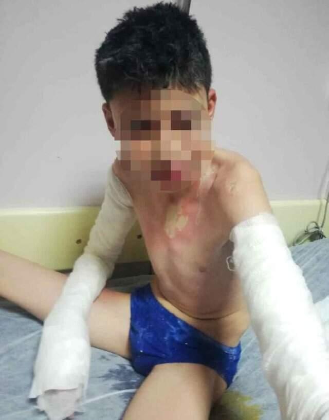 Komşusuna ve Çocuğuna Kezzapla Saldıran Saldırgan Kadın Tahliye Edildi