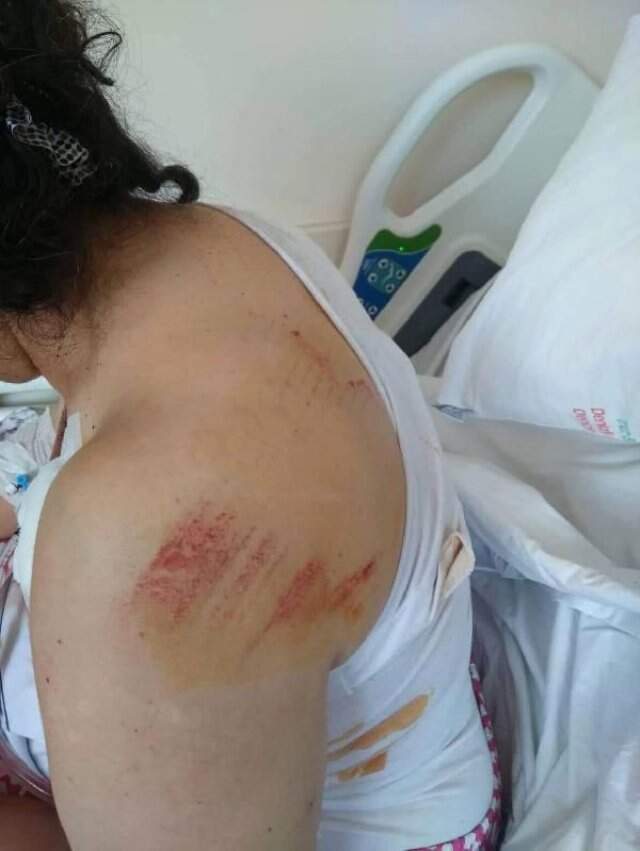 Cani adam, bahçede odun kesen komşusunun kafasına taş atıp balta ile kemiklerini kırdı