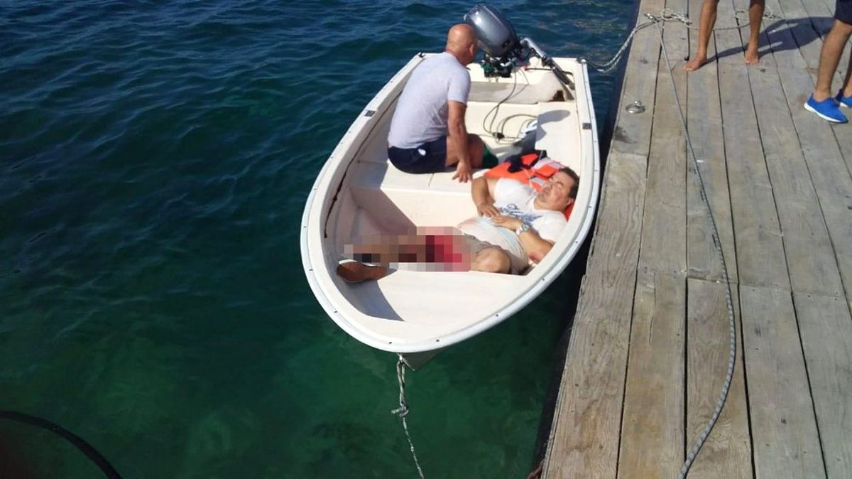 Tekneye sÃ¼rat teknesi Ã§arptÄ±, kaptanÄ±n ayaÄÄ± koptu